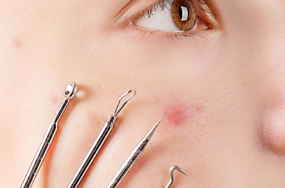 Opkomende puist en snel ingrijpen? Puist.nl!