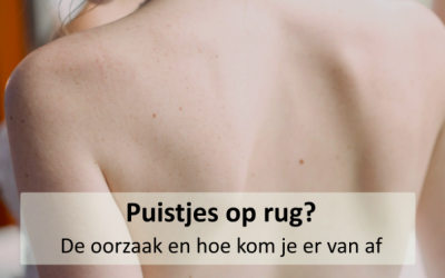 Kennisbank 46 Puistjes op rug? De oorzaak en hoe kom je er van af