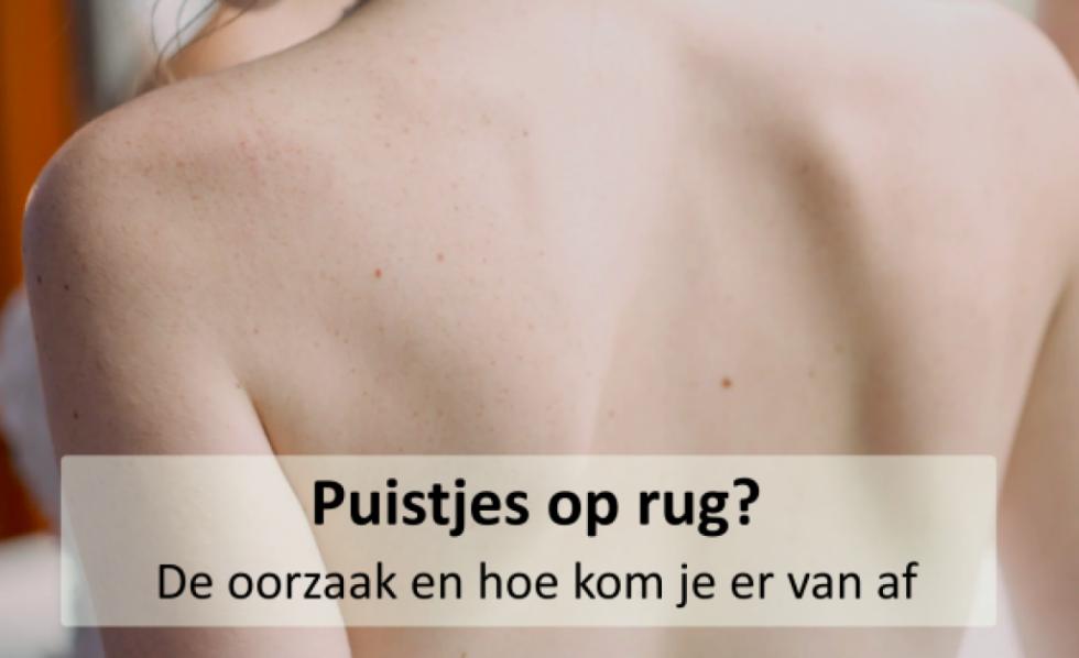 Puistjes op je rug en tips nodig? Bekijk Puist.nl!