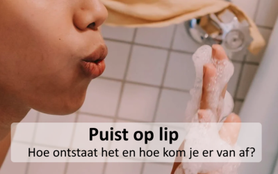 Kennisbank 44 Puist op de lip? Hoe ontstaat het en hoe kom je er vanaf?