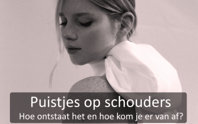 Kennisbank 45 Puistjes op je schouders? Hoe ontstaat het en hoe kom je er van af?